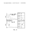 Apparatus and Methods for Titrating Arrhythmia Therapy Based on Spectral     Mapping During Sinus Rhythm diagram and image