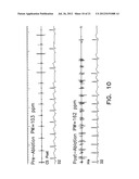 Apparatus and Methods for Titrating Arrhythmia Therapy Based on Spectral     Mapping During Sinus Rhythm diagram and image