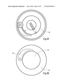 Bone Harvesting Device diagram and image