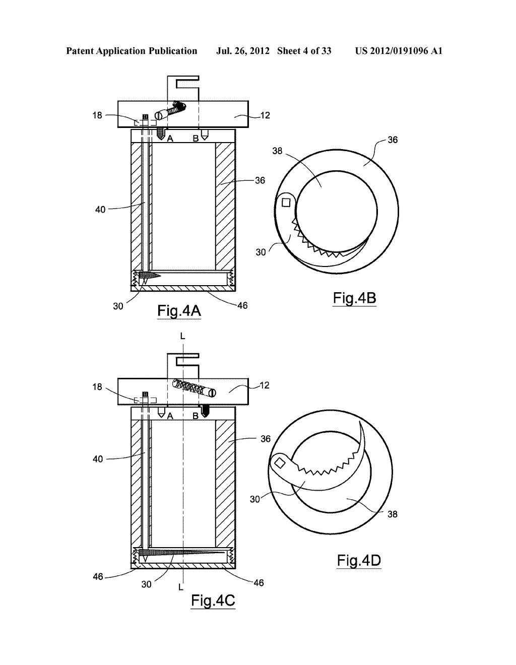 Bone Harvesting Device - diagram, schematic, and image 05