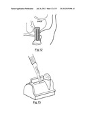 Bone Harvesting Device diagram and image