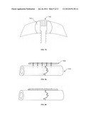 USE OF FLEXIBLE BUSHINGS TO PROMOTE HEALING AND STABLE FRACTURE     COMPRESSION IN ORTHOPEDIC TRAUMA PLATES diagram and image