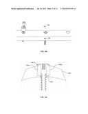 USE OF FLEXIBLE BUSHINGS TO PROMOTE HEALING AND STABLE FRACTURE     COMPRESSION IN ORTHOPEDIC TRAUMA PLATES diagram and image