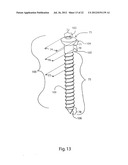 METHODS FOR BONE ALIGNMENT diagram and image