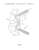 METHODS FOR BONE ALIGNMENT diagram and image