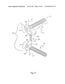 METHODS FOR BONE ALIGNMENT diagram and image