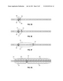 Systems and Methods for Detecting Nerve Stimulation with an Implanted     Prosthesis diagram and image