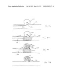 SUPPORT DEVICE FOR A TUBULAR STRUCTURE diagram and image