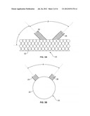 VASCULAR IMPLANTS AND METHODS diagram and image