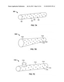 VASCULAR IMPLANTS AND METHODS diagram and image