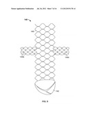 VASCULAR IMPLANTS AND METHODS diagram and image