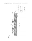 VASCULAR IMPLANTS AND METHODS diagram and image