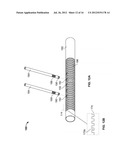 VASCULAR IMPLANTS AND METHODS diagram and image