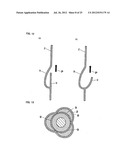 BASE MATERIAL FOR FORMING VALVED LUMEN SHAPE TISSUE, METHOD FOR PRODUCING     VALVED LUMEN SHAPE TISSUE, AND VALVED ARTIFICIAL BLOOD VESSEL diagram and image