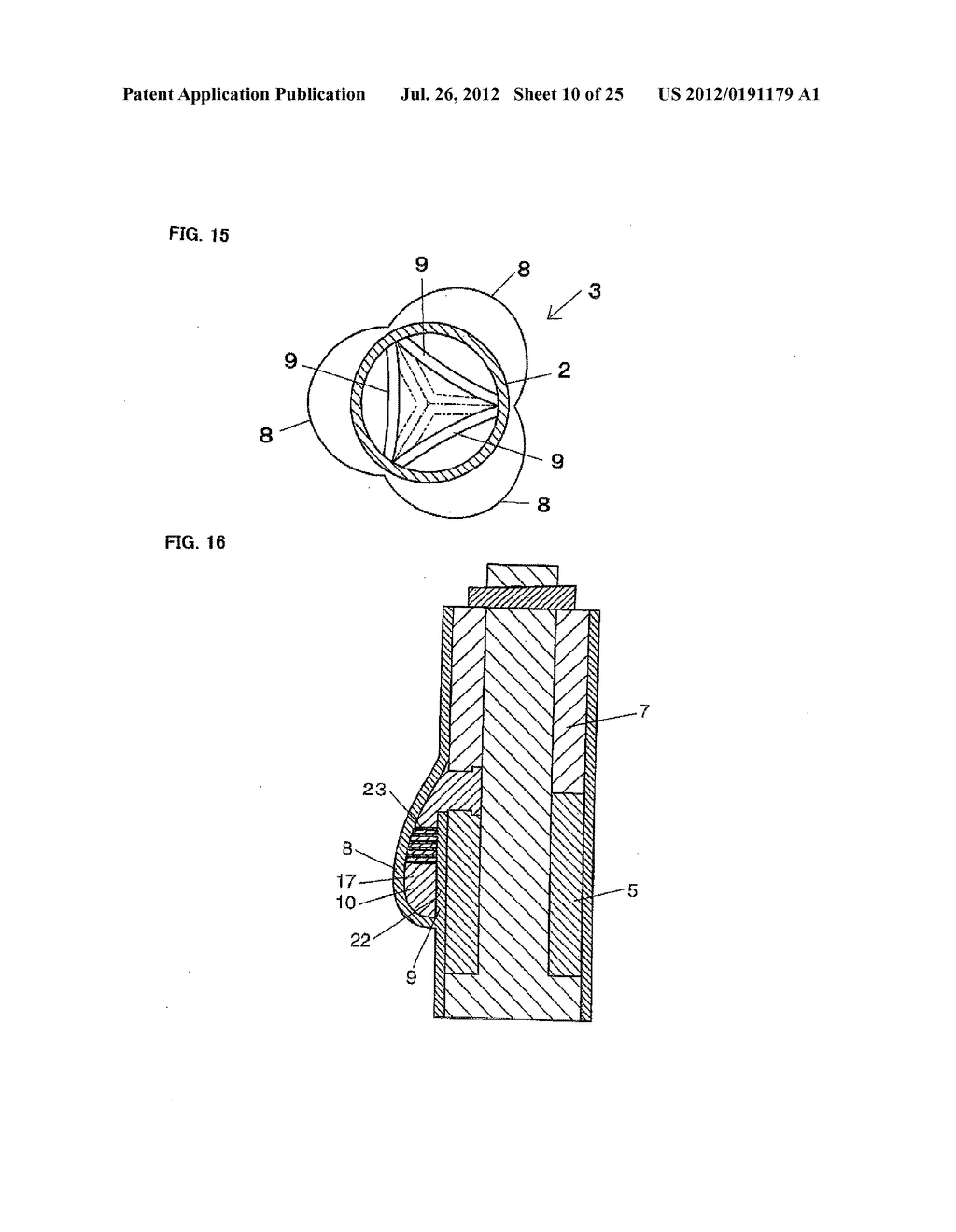 BASE MATERIAL FOR FORMING VALVED LUMEN SHAPE TISSUE, METHOD FOR PRODUCING     VALVED LUMEN SHAPE TISSUE, AND VALVED ARTIFICIAL BLOOD VESSEL - diagram, schematic, and image 11