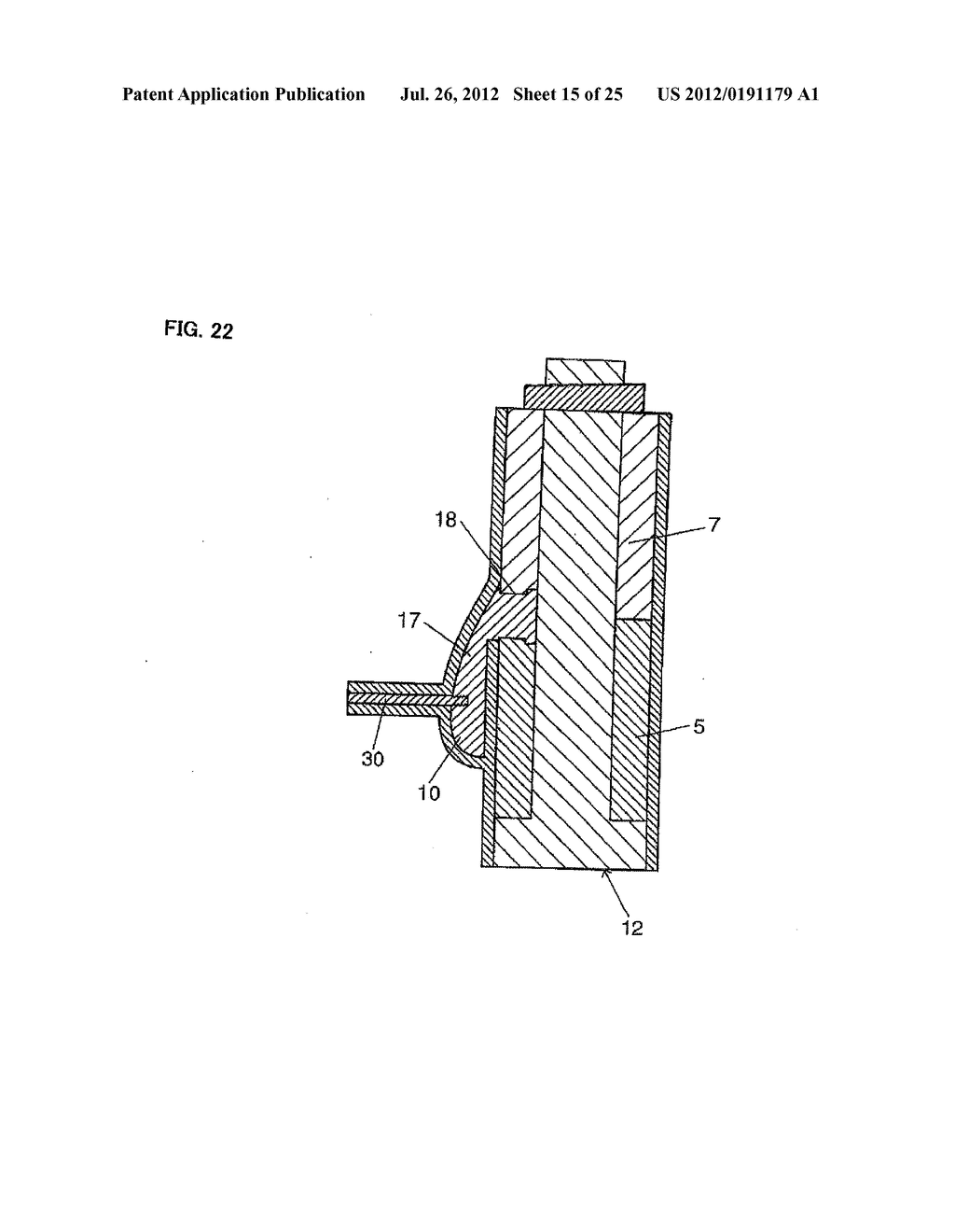 BASE MATERIAL FOR FORMING VALVED LUMEN SHAPE TISSUE, METHOD FOR PRODUCING     VALVED LUMEN SHAPE TISSUE, AND VALVED ARTIFICIAL BLOOD VESSEL - diagram, schematic, and image 16