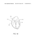 SYSTEMS AND METHODS FOR LOCALIZATION OF A PUNCTURE SITE RELATIVE TO A     MAMMALIAN TISSUE OF INTEREST diagram and image