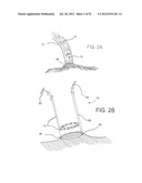 SYSTEMS AND METHODS FOR LOCALIZATION OF A PUNCTURE SITE RELATIVE TO A     MAMMALIAN TISSUE OF INTEREST diagram and image