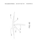 SYSTEMS AND METHODS FOR LOCALIZATION OF A PUNCTURE SITE RELATIVE TO A     MAMMALIAN TISSUE OF INTEREST diagram and image