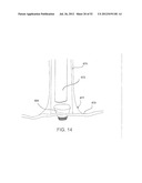 SYSTEMS AND METHODS FOR LOCALIZATION OF A PUNCTURE SITE RELATIVE TO A     MAMMALIAN TISSUE OF INTEREST diagram and image