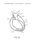 SYSTEMS AND METHODS FOR LOCALIZATION OF A PUNCTURE SITE RELATIVE TO A     MAMMALIAN TISSUE OF INTEREST diagram and image