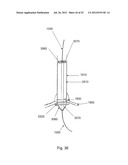 SYSTEMS AND METHODS FOR LOCALIZATION OF A PUNCTURE SITE RELATIVE TO A     MAMMALIAN TISSUE OF INTEREST diagram and image