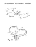 HERMETICALLY SEALED PROSTHETIC COMPONENT AND METHOD THEREFOR diagram and image