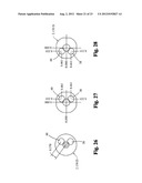 Sliding Valve Aspiration diagram and image