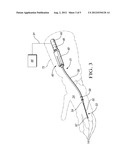 SYSTEM AND METHOD FOR TENSIONING A ROBOTICALLY ACTUATED TENDON diagram and image