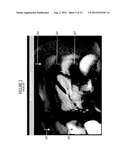 System for Suppression of Artifacts in MR Imaging diagram and image