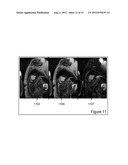 Method for independent manipulation of a fat and a water component in     Magnetic Resonance Imaging diagram and image