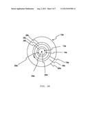 Contact Lens Sets And Methods To Prevent Or Slow Progression Of Myopia Or     Hyperopia diagram and image