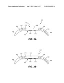 Wrist-Worn Electronic Device and Methods Therefor diagram and image