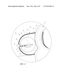 ILLUMINATING SCISSORS AND METHODS OF USE diagram and image