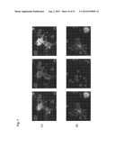 Monoclonal Antibodies Against Claudin-18 For Treatment of Cancer diagram and image