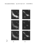 Monoclonal Antibodies Against Claudin-18 For Treatment of Cancer diagram and image