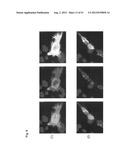 Monoclonal Antibodies Against Claudin-18 For Treatment of Cancer diagram and image