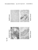 Monoclonal Antibodies Against Claudin-18 For Treatment of Cancer diagram and image