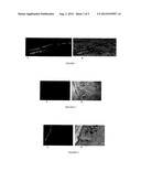 NOVEL NANOPARTICLE FORMULATIONS FOR SKIN DELIVERY diagram and image