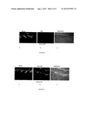 NOVEL NANOPARTICLE FORMULATIONS FOR SKIN DELIVERY diagram and image