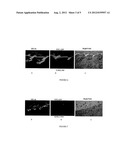 NOVEL NANOPARTICLE FORMULATIONS FOR SKIN DELIVERY diagram and image