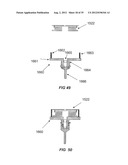 CYTOBLOCK PREPARATION SYSTEM AND METHODS OF USE diagram and image