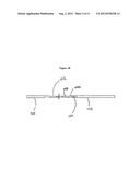 DEVICE FOR REMOVING CUMULUS FROM OOCYTES diagram and image