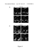 COMPOSITIONS AND METHODS TO CONTROL ANGIOGENESIS WITH CUPREDOXINS diagram and image