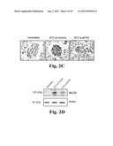 PREVENTING ISLET INFLAMMATION AND DYSFUNCTION AND MAINTAINING PROPER     GLUCOSE LEVELS BY CONTROLLING eIF5A  AND ITS HYPUSINATION diagram and image