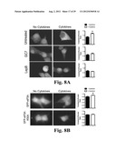 PREVENTING ISLET INFLAMMATION AND DYSFUNCTION AND MAINTAINING PROPER     GLUCOSE LEVELS BY CONTROLLING eIF5A  AND ITS HYPUSINATION diagram and image