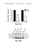 PREVENTING ISLET INFLAMMATION AND DYSFUNCTION AND MAINTAINING PROPER     GLUCOSE LEVELS BY CONTROLLING eIF5A  AND ITS HYPUSINATION diagram and image