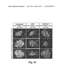 PREVENTING ISLET INFLAMMATION AND DYSFUNCTION AND MAINTAINING PROPER     GLUCOSE LEVELS BY CONTROLLING eIF5A  AND ITS HYPUSINATION diagram and image