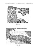 ANTISENSE OLIGONUCLEOTIDES AGAINST ACETYLCHOLINESTERASE FOR TREATING     INFLAMMATORY DISEASES diagram and image