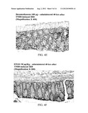 ANTISENSE OLIGONUCLEOTIDES AGAINST ACETYLCHOLINESTERASE FOR TREATING     INFLAMMATORY DISEASES diagram and image